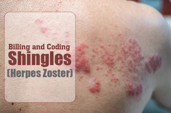 Billing and Coding for Shingles – A Painful Skin Condition