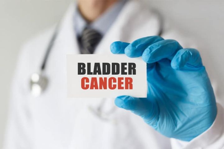 Bladder Cancer & Its Related ICD- Diagnosis Codes