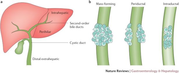 Cholangiocarcinoma: current knowledge and future perspectives