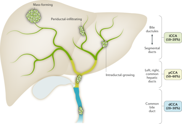 Cholangiocarcinoma : the next horizon in mechanisms and
