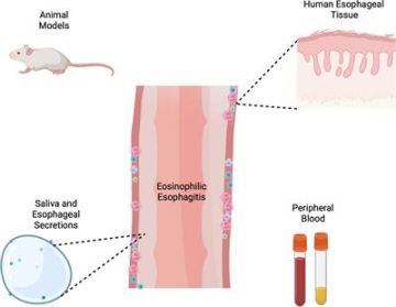 Frontiers  Models and Tools for Investigating Eosinophilic