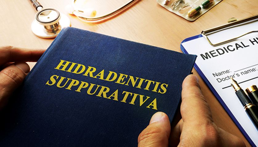 Hidradenitis Suppurativa: Diagnosis, Treatment, and Coding - AAPC