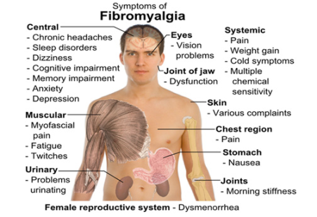 ICD- Brings Recognition of Fibromyalgia to Health Care Industry