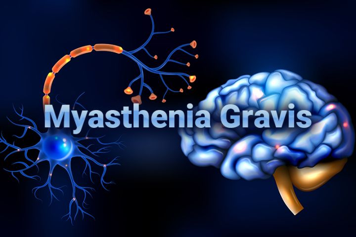 ICD- Codes for Reporting Myasthenia Gravis (MG)