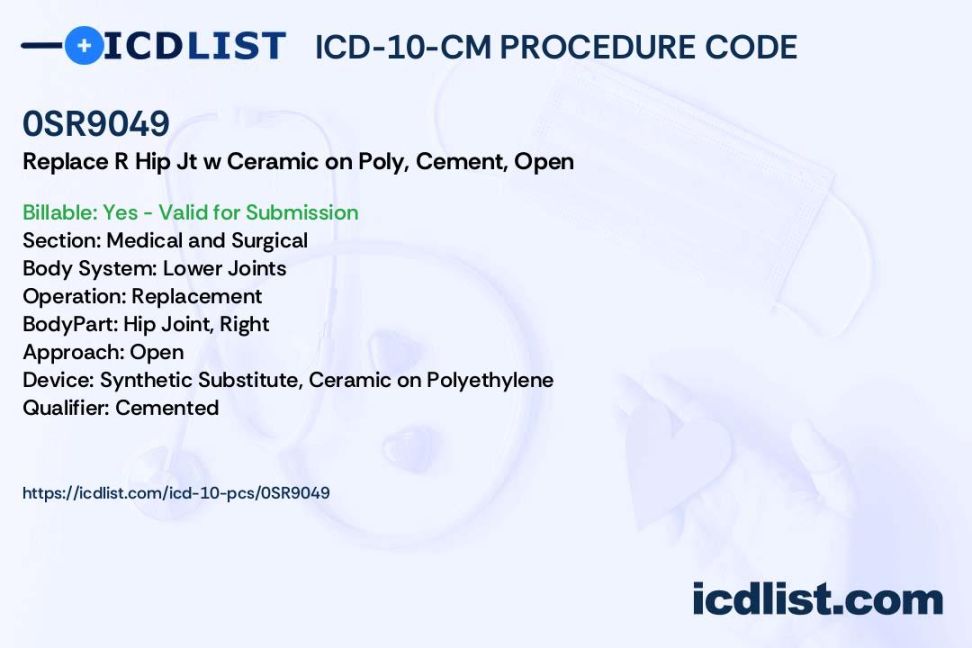 ICD--PCS Procedure Code SR949 - Replacement of Right Hip Joint