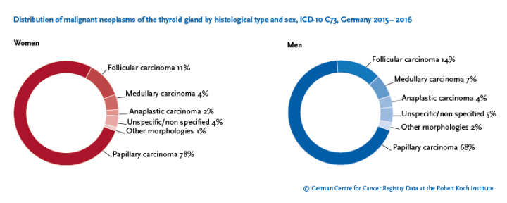 Krebs - Thyroid cancer