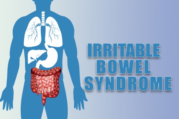 Medical Codes to Report Irritable Bowel Syndrome (IBS)