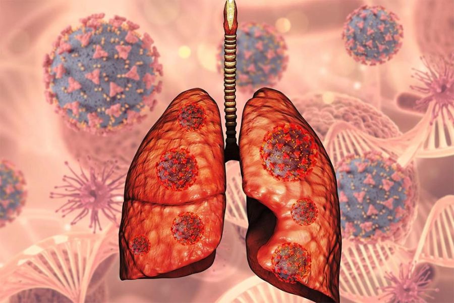 Metastatic Lung Cancer and ICD-: A New Perspective on Diagnosis